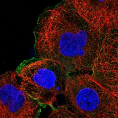 Immunocytochemistry/ Immunofluorescence: MEK1 Antibody [NBP1-87790]