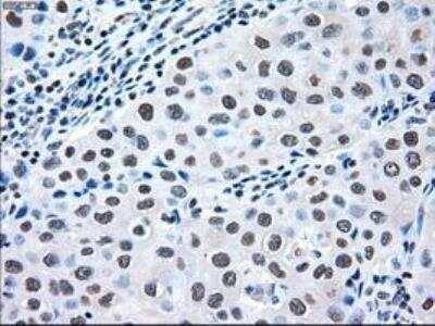 Immunohistochemistry-Paraffin: MEK2 Antibody (OTI8G6) [NBP1-47836]
