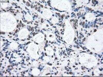 Immunohistochemistry-Paraffin: MEK2 Antibody (OTI8G6) [NBP1-47836]