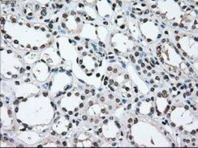 Immunohistochemistry-Paraffin: MEK2 Antibody (OTI8G6) [NBP1-47836]