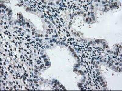 Immunohistochemistry-Paraffin: MEK2 Antibody (OTI8G6) [NBP1-47836]
