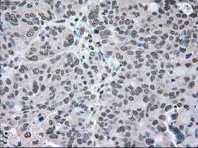 Immunohistochemistry-Paraffin: MEK2 Antibody (OTI8G6) [NBP1-47836]
