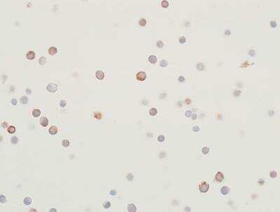 Immunocytochemistry: MEK2 Antibody (BLR079G) [NBP2-78800]