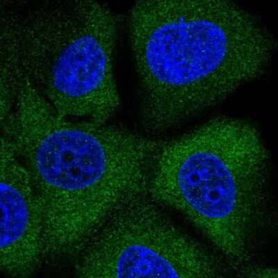Immunocytochemistry/ Immunofluorescence: MEK2 Antibody [NBP2-38660]