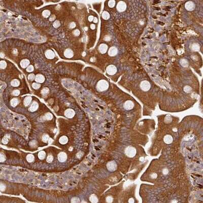 Immunohistochemistry: MEK2 Antibody [NBP2-38660]
