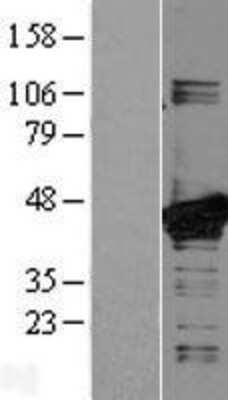 Western Blot: MKK3/MEK3 Overexpression Lysate [NBL1-12848]