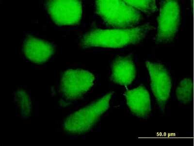 Immunocytochemistry/ Immunofluorescence: MEK5 Antibody (3E10) [H00005607-M11]