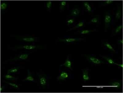 Immunocytochemistry/ Immunofluorescence: MEK5 Antibody (M1-E6) [H00005607-M01]