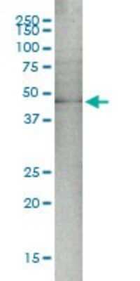 Western Blot: MEK5 Antibody (M1-E6) [H00005607-M01]
