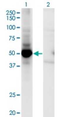 Western Blot: MEK5 Antibody (M1-E6) [H00005607-M01]