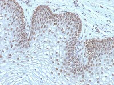 Immunohistochemistry-Paraffin: MEKK1 Antibody (2F6) - Azide and BSA Free [NBP2-47810]