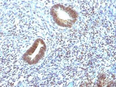 Immunohistochemistry-Paraffin: MEKK1 Antibody (2F6) - IHC-Prediluted [NBP2-48208]