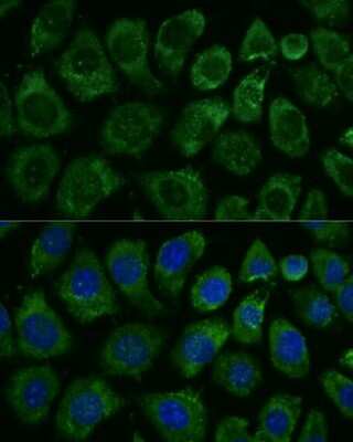 Immunocytochemistry/ Immunofluorescence: MEKK1 Antibody - Azide and BSA Free [NBP3-02962]