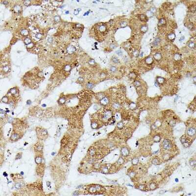 Immunohistochemistry-Paraffin: MEKK1 Antibody - Azide and BSA Free [NBP3-02962]