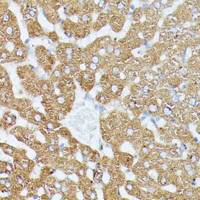 Immunohistochemistry-Paraffin: MEKK1 Antibody - Azide and BSA Free [NBP3-02962]