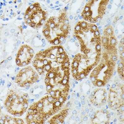 Immunohistochemistry-Paraffin: MEKK1 Antibody - Azide and BSA Free [NBP3-02962]
