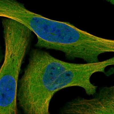 Immunocytochemistry/ Immunofluorescence: MEKK2 Antibody [NBP2-48554]