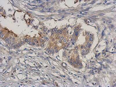 Immunohistochemistry-Paraffin: MEKK3 Antibody [NBP2-17273]