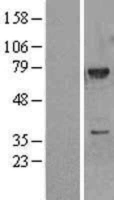 Western Blot: MEKK3 Overexpression Lysate [NBL1-12855]