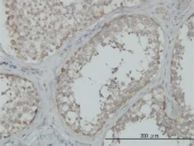Immunohistochemistry-Paraffin: MEKK4 Antibody (6C6) [H00004216-M02]