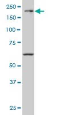 Western Blot: MEKK4 Antibody (6C6) [H00004216-M02]