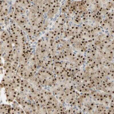 Immunohistochemistry-Paraffin: MEKK4 Antibody [NBP1-87734]