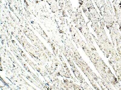 Immunohistochemistry-Paraffin: MEKK4 Antibody [NBP3-12324]