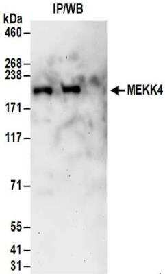 Immunoprecipitation: MEKK4 Antibody [NBP2-32187]