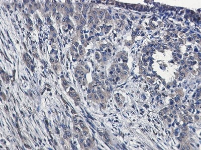 Immunohistochemistry-Paraffin: MEKK4 Antibody (S05-8A5) [NBP3-19990]