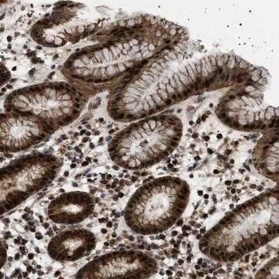 Immunohistochemistry-Paraffin: MELK Antibody [NBP1-83031]