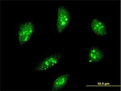 Immunocytochemistry/ Immunofluorescence: MEOX 2 Antibody (4E10) [H00004223-M10]