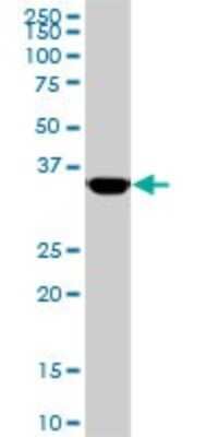 Western Blot: MEOX 2 Antibody (5A6) [H00004223-M02]