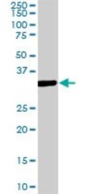 Western Blot: MEOX 2 Antibody (5E1) [H00004223-M08]