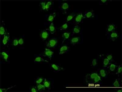 Immunocytochemistry/ Immunofluorescence: MEOX 2 Antibody (6A5) [H00004223-M03]