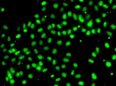 Immunocytochemistry/ Immunofluorescence: MEPCE Antibody - BSA Free [NBP3-05056]