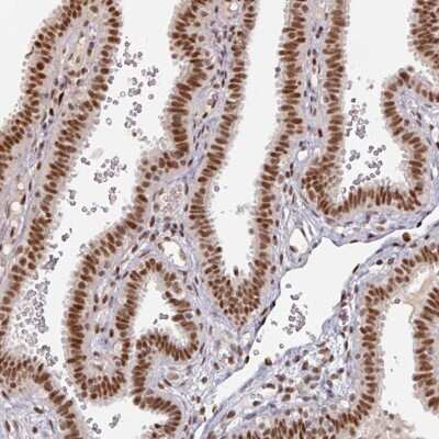 Immunohistochemistry-Paraffin: MEPCE Antibody [NBP2-33619]