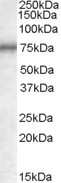 Western Blot: MEPCE Antibody [NBP1-28464]