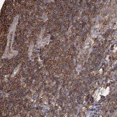 Immunohistochemistry: MEPE/OF45 Antibody [NBP1-90993]