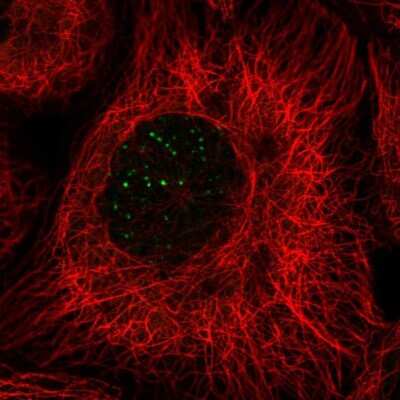 Immunocytochemistry/ Immunofluorescence: MERIT40/HSPC142 Antibody [NBP2-58126]