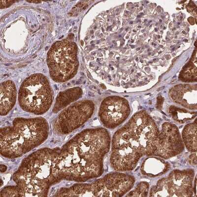 Immunohistochemistry-Paraffin: MERIT40/HSPC142 Antibody [NBP2-49568]