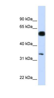 Western Blot: MERIT40/HSPC142 Antibody [NBP1-56773]