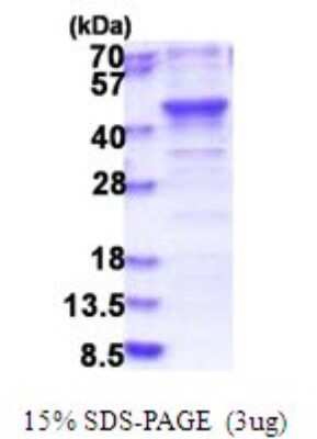 SDS-PAGE: Recombinant Human MERIT40/HSPC142 His Protein [NBP2-51793]