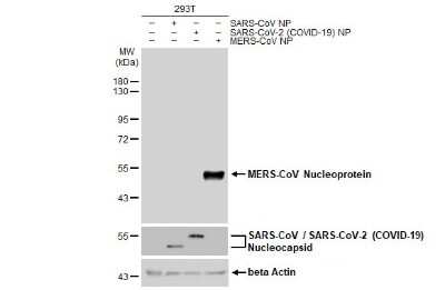 Western Blot: MERS-CoV Nucleoprotein Antibody [NBP3-13422]