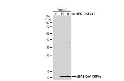 Western Blot: MERS-CoV ORF4a Antibody [NBP3-13423]