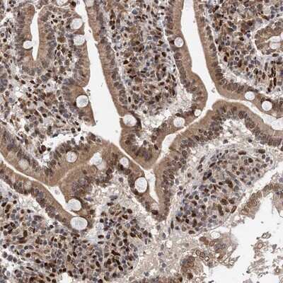 Immunohistochemistry-Paraffin: MESDC2 Antibody [NBP1-88555]