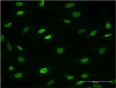 Immunocytochemistry/ Immunofluorescence: MESP2 Antibody (1C8) [H00145873-M01]