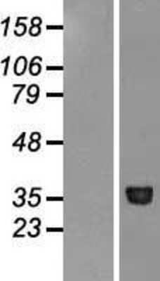 Western Blot: Methionine Aminopeptidase 1/METAP1 Overexpression Lysate [NBL1-13018]