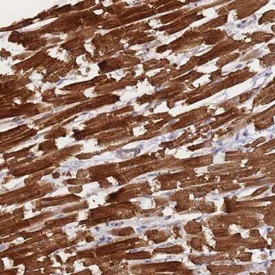 Immunohistochemistry-Paraffin: Meteorin Antibody [NBP2-14231]
