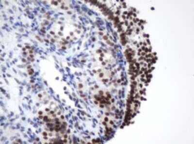 Immunohistochemistry: METT10D Antibody (OTI3E8) [NBP2-45823]