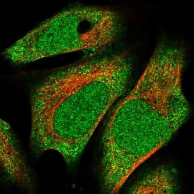 Immunocytochemistry/ Immunofluorescence: METT10D Antibody [NBP1-81239]
